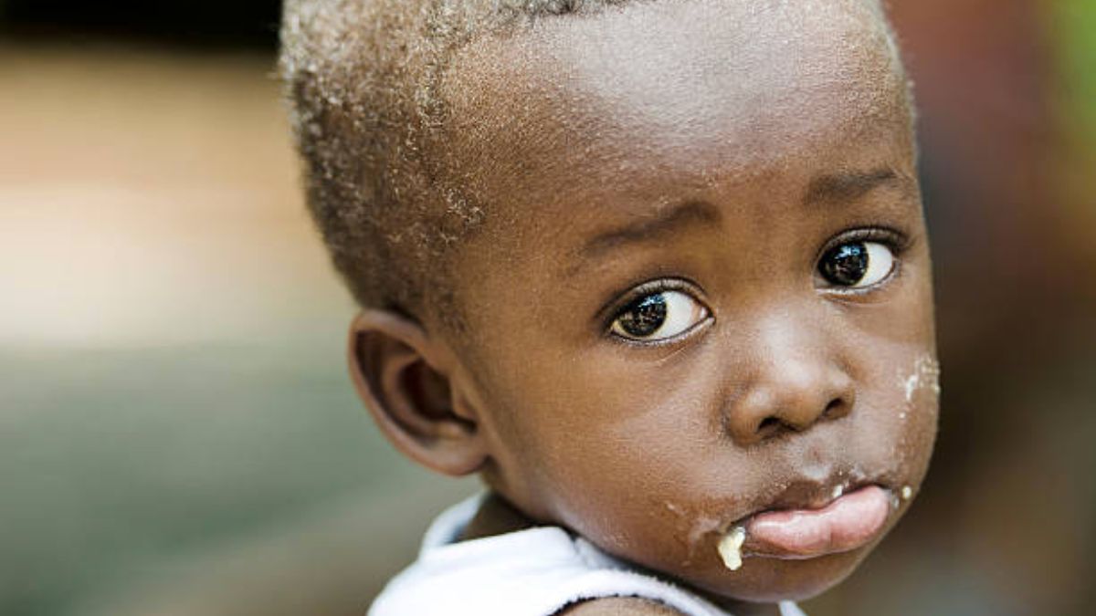 Crise alimentaire au Soudan, des enfants de moins 5 ans meurent de faim.